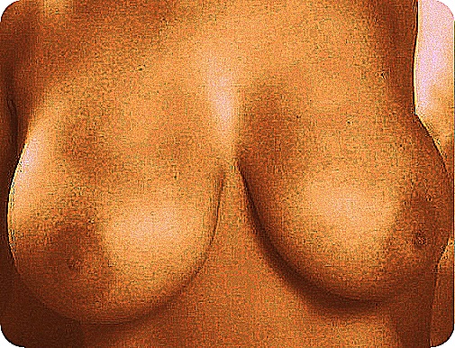 3 Premio TETAS BRONCE.jpg